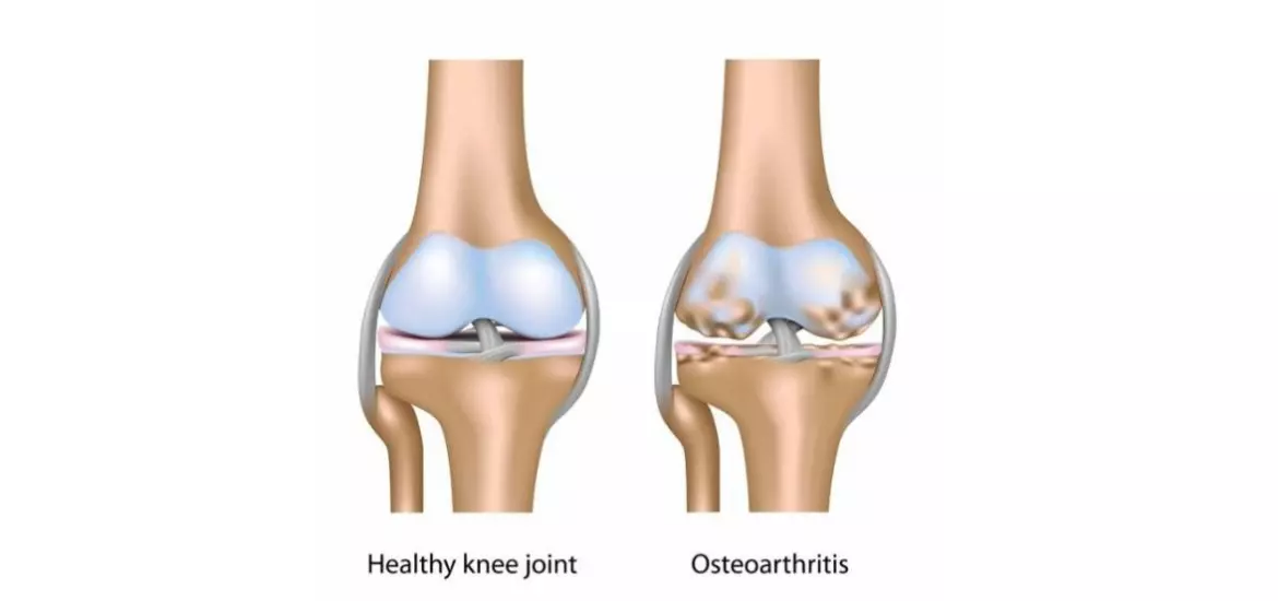 anyconv.com รูปทำเว็ปไซต์ใหม่ (2)