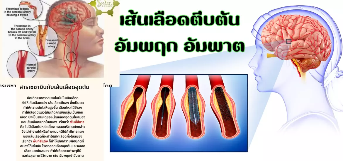 anyconv.com รูปทำเว็ปไซต์ใหม่ (6)